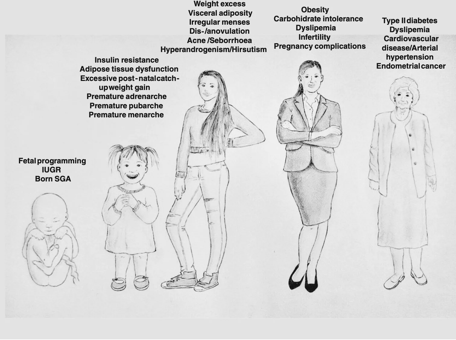 SOPK à tous les âges d cela vie