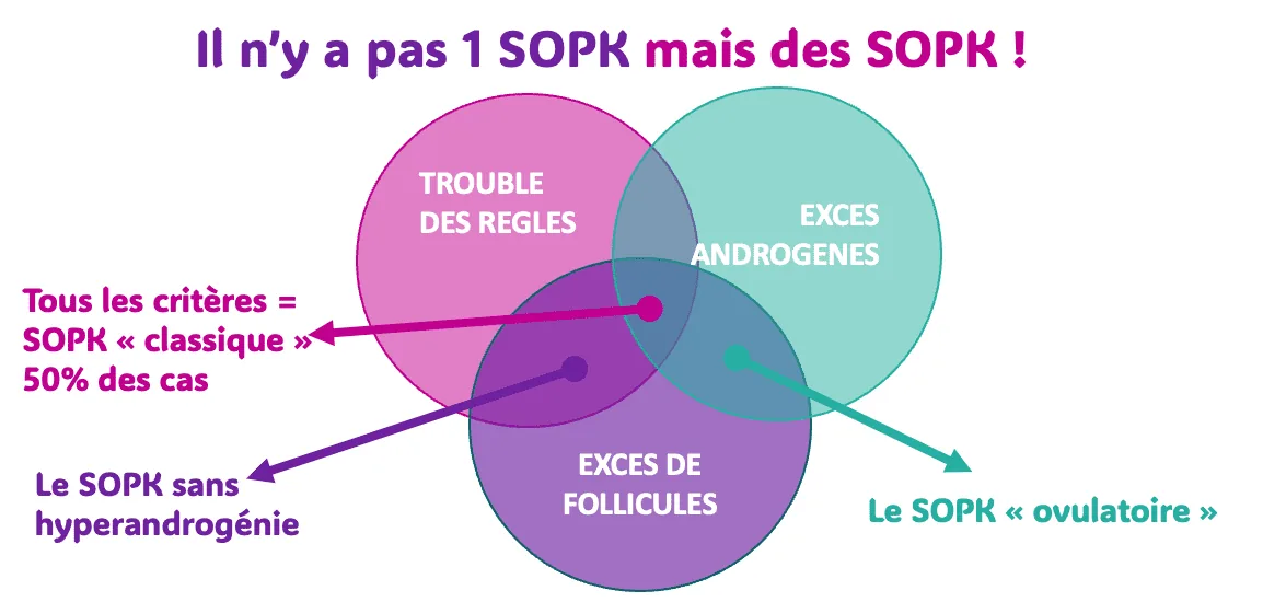 Il n'y a pas 1 SOPK mais différents SOPK avec symptômes différents